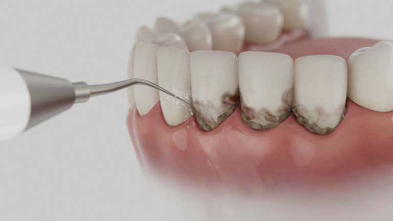 Trusted Tooth Extraction service in Lake Waynoka, OH - Dentist Open Now